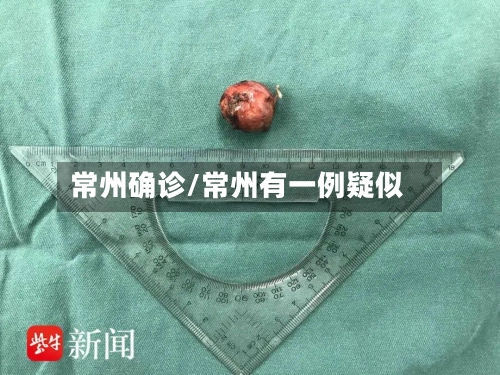 常州确诊/常州有一例疑似-第1张图片