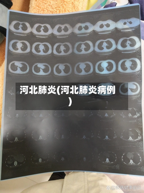 河北肺炎(河北肺炎病例)-第2张图片
