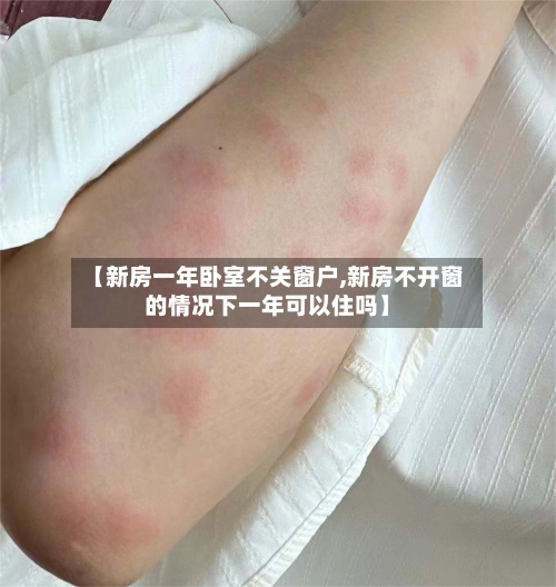 【新房一年卧室不关窗户,新房不开窗的情况下一年可以住吗】-第1张图片
